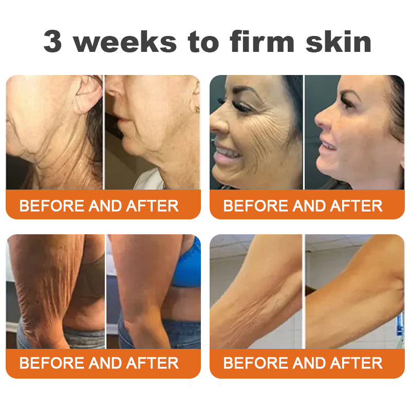 ✅✅Made and Shipped from UK🇬🇧 Rolimey® Botox Bee Venom Firming Serum Stick✅(LAST DAY 70% OFF)
