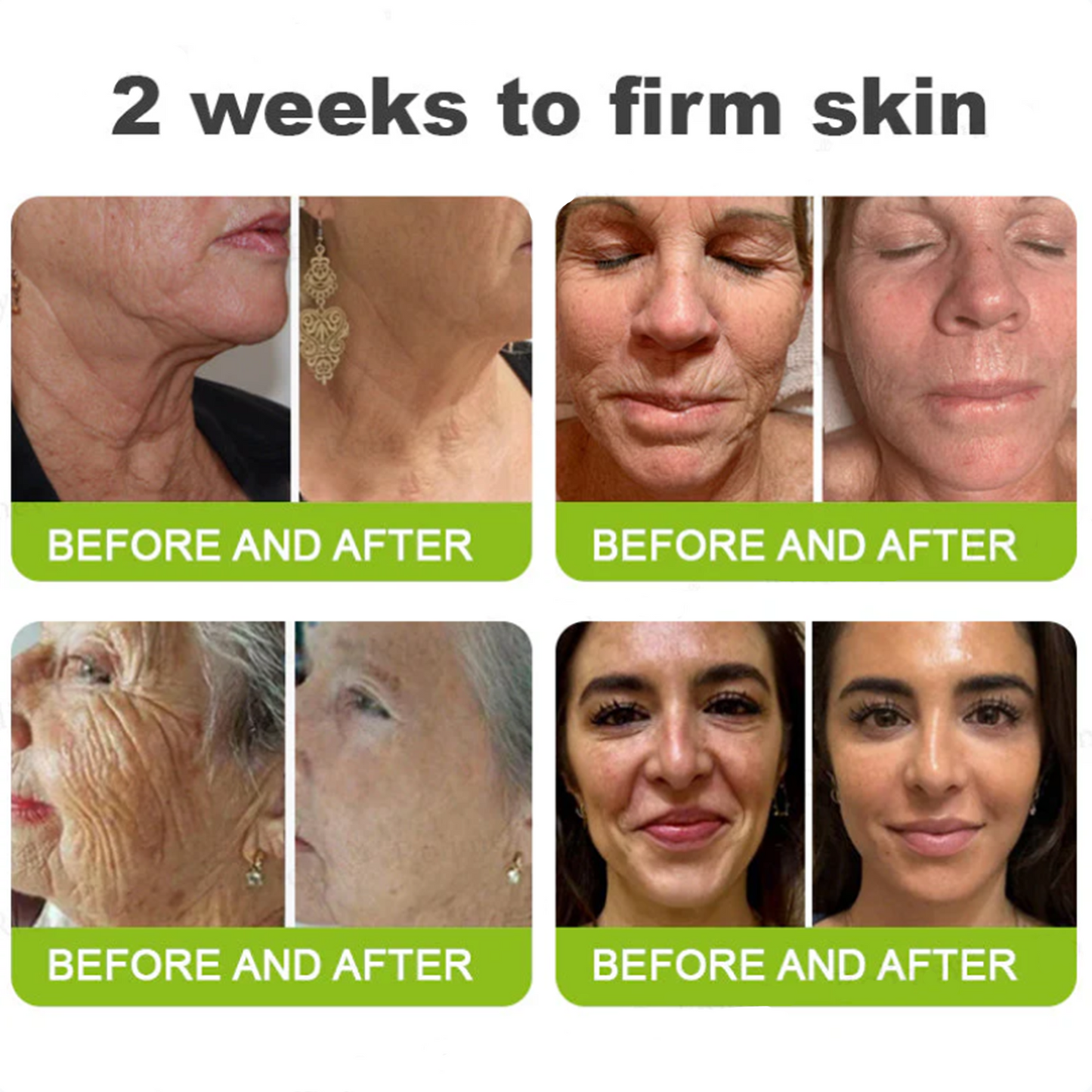 Dr. Fachmer®👀Peptide Collagen INSTANT TIGHTENING + PEPTIDE FIRMING CARE, Instantly smooths puffiness and lines while supporting firmer skin with continued use