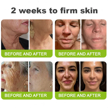 Dr. Fachmer®👀Peptide Collagen INSTANT TIGHTENING + PEPTIDE FIRMING CARE, Instantly smooths puffiness and lines while supporting firmer skin with continued use