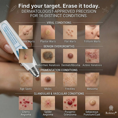 ✍️Official Brand Store | Rolimey® 🖊️ 7-Day Tag & Spot Eraser (Zero Pain, Zero Scars Rollerball) 🌱