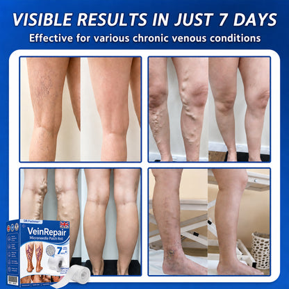 🌿DR.Fachmer® Vein Ease Microneedle Care Patch(For Spider Veins, Varicose Veins, Swelling & Leg Fatigue) - Last Day Promotion 50% OFF
