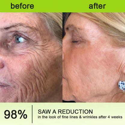 Dr. Fachmer®👀Peptide Collagen INSTANT TIGHTENING + PEPTIDE FIRMING CARE, Instantly smooths puffiness and lines while supporting firmer skin with continued use