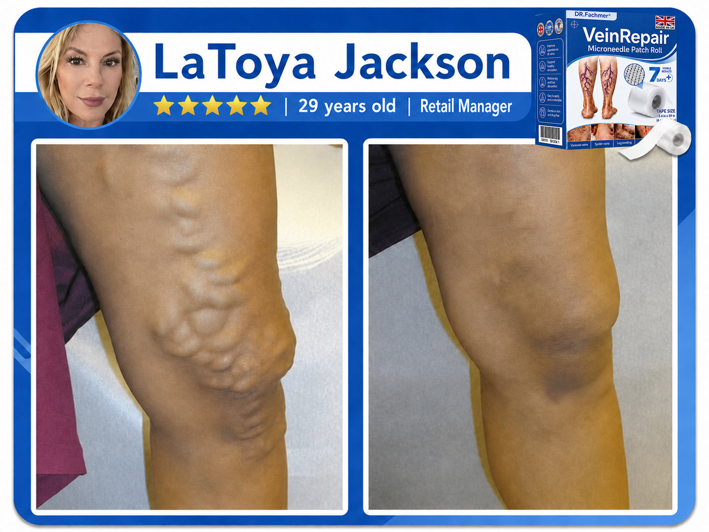 🌿DR.Fachmer® Vein Ease Microneedle Care Patch(For Spider Veins, Varicose Veins, Swelling & Leg Fatigue) - Last Day Promotion 50% OFF