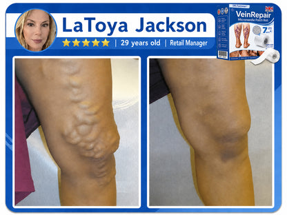 🌿DR.Fachmer® Vein Ease Microneedle Care Patch(For Spider Veins, Varicose Veins, Swelling & Leg Fatigue) - Last Day Promotion 50% OFF