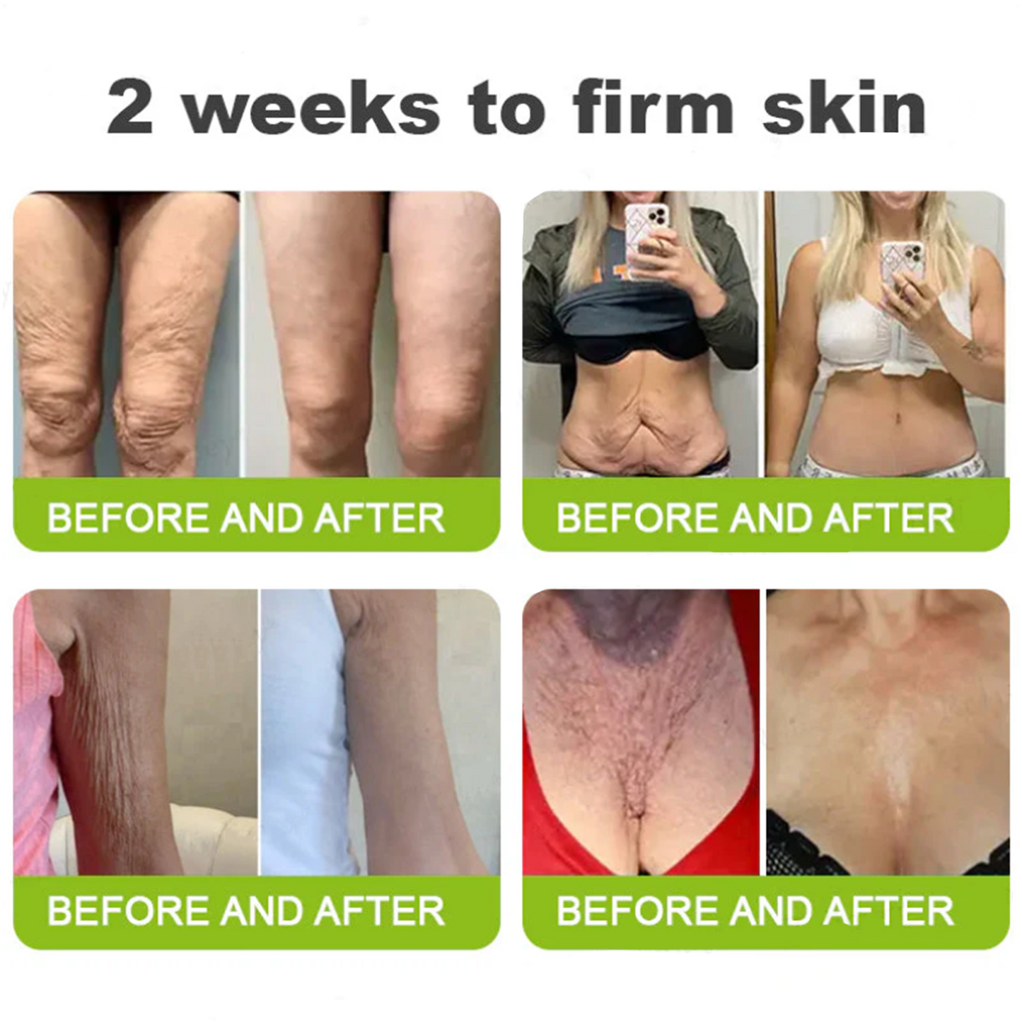 Dr. Fachmer®👀Peptide Collagen INSTANT TIGHTENING + PEPTIDE FIRMING CARE, Instantly smooths puffiness and lines while supporting firmer skin with continued use