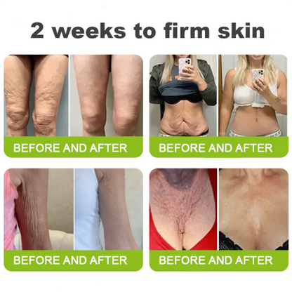 Dr. Fachmer®👀Peptide Collagen INSTANT TIGHTENING + PEPTIDE FIRMING CARE, Instantly smooths puffiness and lines while supporting firmer skin with continued use
