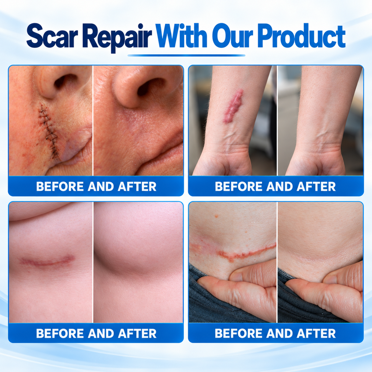 Dr.Fachmer® 🩹Bio-Regenerative Micro-Needle Scar Patch –Repair Protein Silicone Scar Care for C-Section & Post-Surgical Scars