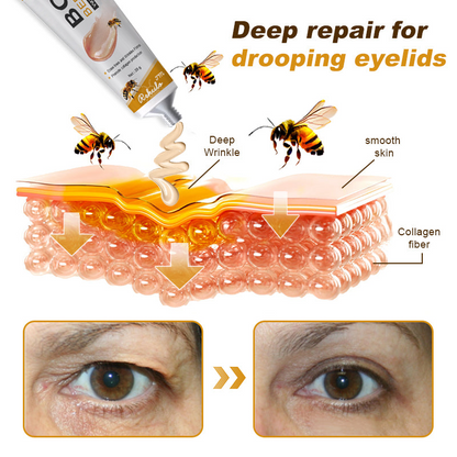 🌲👩‍⚕️(🐝Made and Shipped from UK✅) Furzero™ Botox Bee Venom Wrinkle Removal Cream- LAST DAY 70% OFF