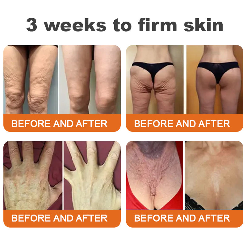 ✅✅Made and Shipped from UK🇬🇧 Rolimey® Botox Bee Venom Firming Serum Stick✅(LAST DAY 70% OFF)