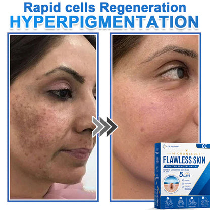 🩹 𝑫𝑹.𝑭𝒂𝒄𝒉𝒎𝒆𝒓® 2-𝒊𝒏-1 𝑴𝒊𝒄𝒓𝒐𝒏𝒆𝒆𝒅𝒍𝒆 & 𝑯𝒚𝒅𝒓𝒐𝒄𝒐𝒍𝒍𝒐𝒊𝒅 𝑷𝒂𝒕𝒄𝒉 | 𝑹𝒂𝒊𝒔𝒆𝒅 𝑴𝒐𝒍𝒆𝒔,𝑨𝒄𝒏𝒆,  𝑭𝒍𝒂𝒕 𝑾𝒂𝒓𝒕𝒔 & 𝑺𝒌𝒊𝒏 𝑻𝒂𝒈𝒔 𝑹𝒆𝒎𝒐𝒗𝒆𝒓 | 𝑰𝒎𝒑𝒓𝒐𝒗𝒆𝒔 𝑾𝒓𝒊𝒏𝒌𝒍𝒆𝒔, 𝑺𝒄𝒂𝒓𝒔 & 𝑩𝒍𝒆𝒎𝒊𝒔𝒉𝒆𝒔 | 𝑰𝒏𝒗𝒊𝒔𝒊𝒃𝒍𝒆 𝑷𝒊𝒎𝒑𝒍𝒆 𝑷𝒂𝒕𝒄𝒉𝒆𝒔 𝒇𝒐𝒓 𝑭𝒂𝒄𝒆 & 𝑩𝒐𝒅𝒚