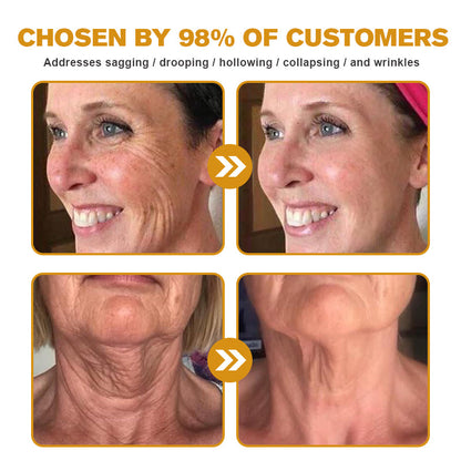 🌲👩‍⚕️(🐝Made and Shipped from UK✅) Furzero™ Botox Bee Venom Wrinkle Removal Cream- LAST DAY 70% OFF